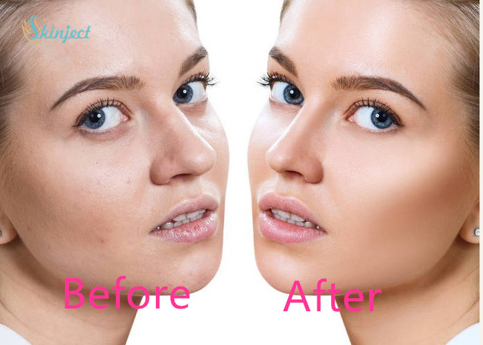 Mesotherapy Serum Moisturizing And Brightening 18AA+ Repair Damaged 5ml