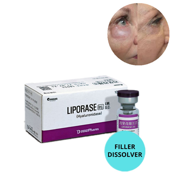 Korea Liporase Hyaluronidase Hayluronic Acid Dermal Filler Dissolving Injection