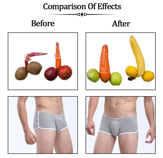 10 Ml Skinject Sub-Skin Penis Enlargement HA Cross Linked Dermal Filler Boob And Buttocks Injection