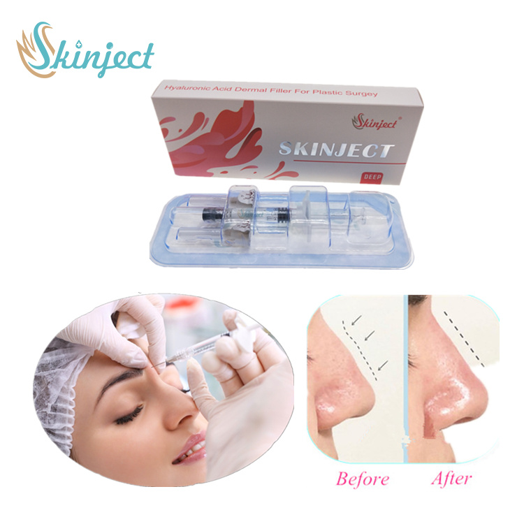 Skinject 5ml Deep Anti Aging Hyaluronic Acid Injection Dermal Filler Facial Wrinkle Removal